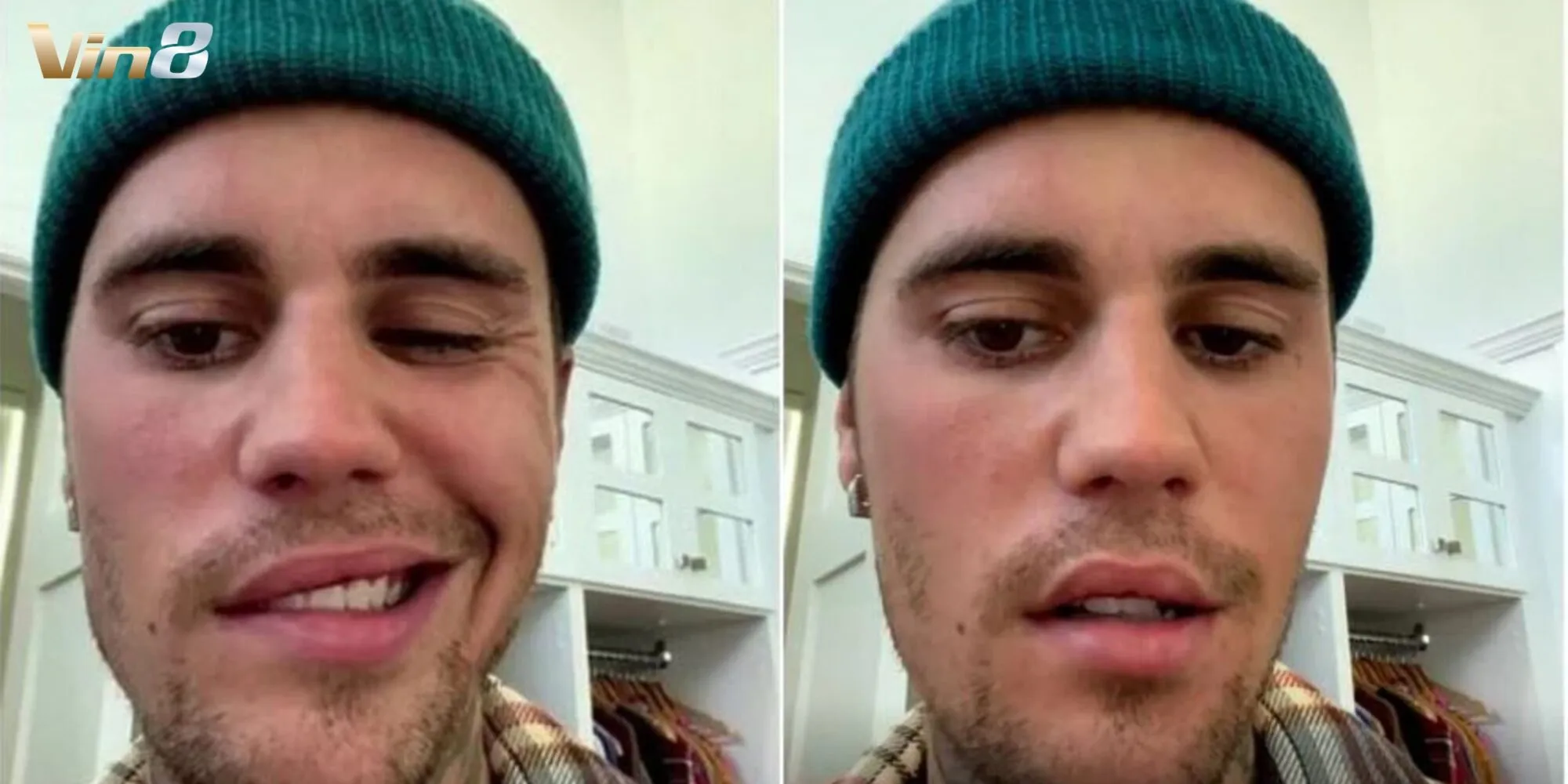 Justin Bieber chiến đấu với bệnh Lyme và hội chứng Ramsay Hunt
